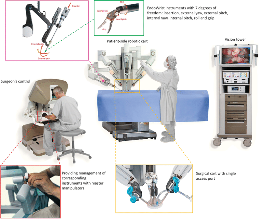 Robotic Surgery Room Layout & Equipment