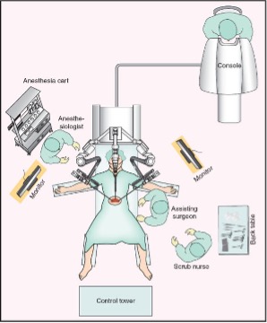 Laparoscopy with Robotic Room Layout